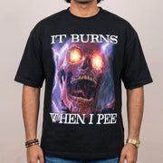 Es brennt beim Pinkeln – T-Shirt