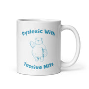 Dyslektiker mit Tassive Mits Weißer glänzender Becher